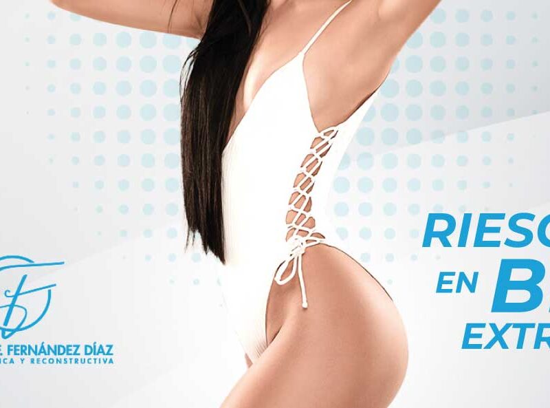 Riesgos de un BBL extremo y cómo lograr resultados seguros en Guadalajara