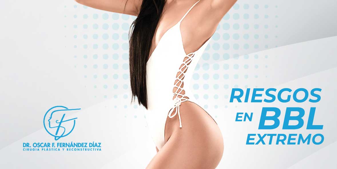 Riesgos de un BBL extremo y cómo lograr resultados seguros en Guadalajara