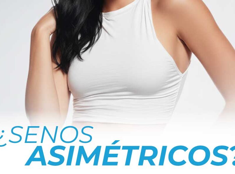 La solución para los senos asimétricos: Implantes personalizados para corregir senos asimétricos en Guadalajara