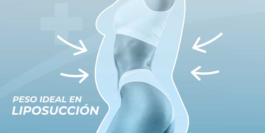 El peso ideal antes de una liposucción