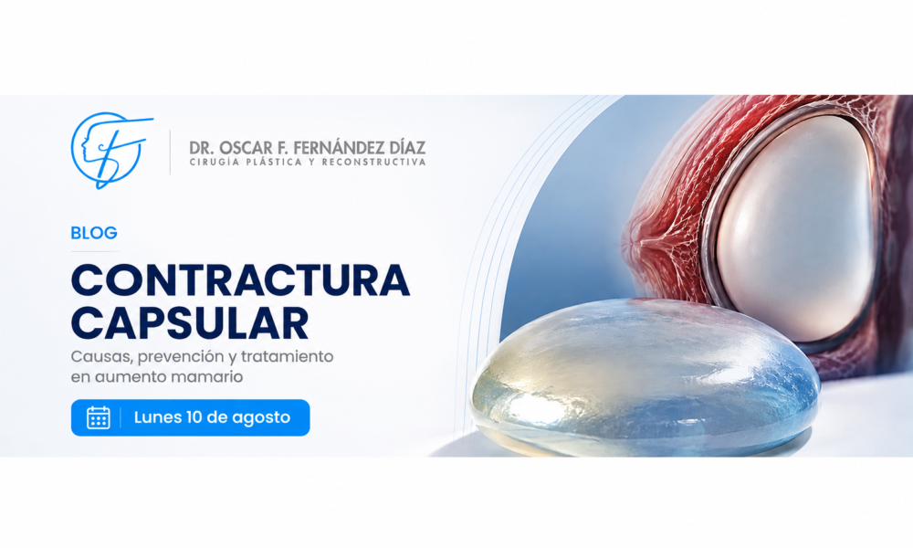 Dr. Oscar Fernández explica qué es la contractura capsular después de un aumento mamario en Guadalajara