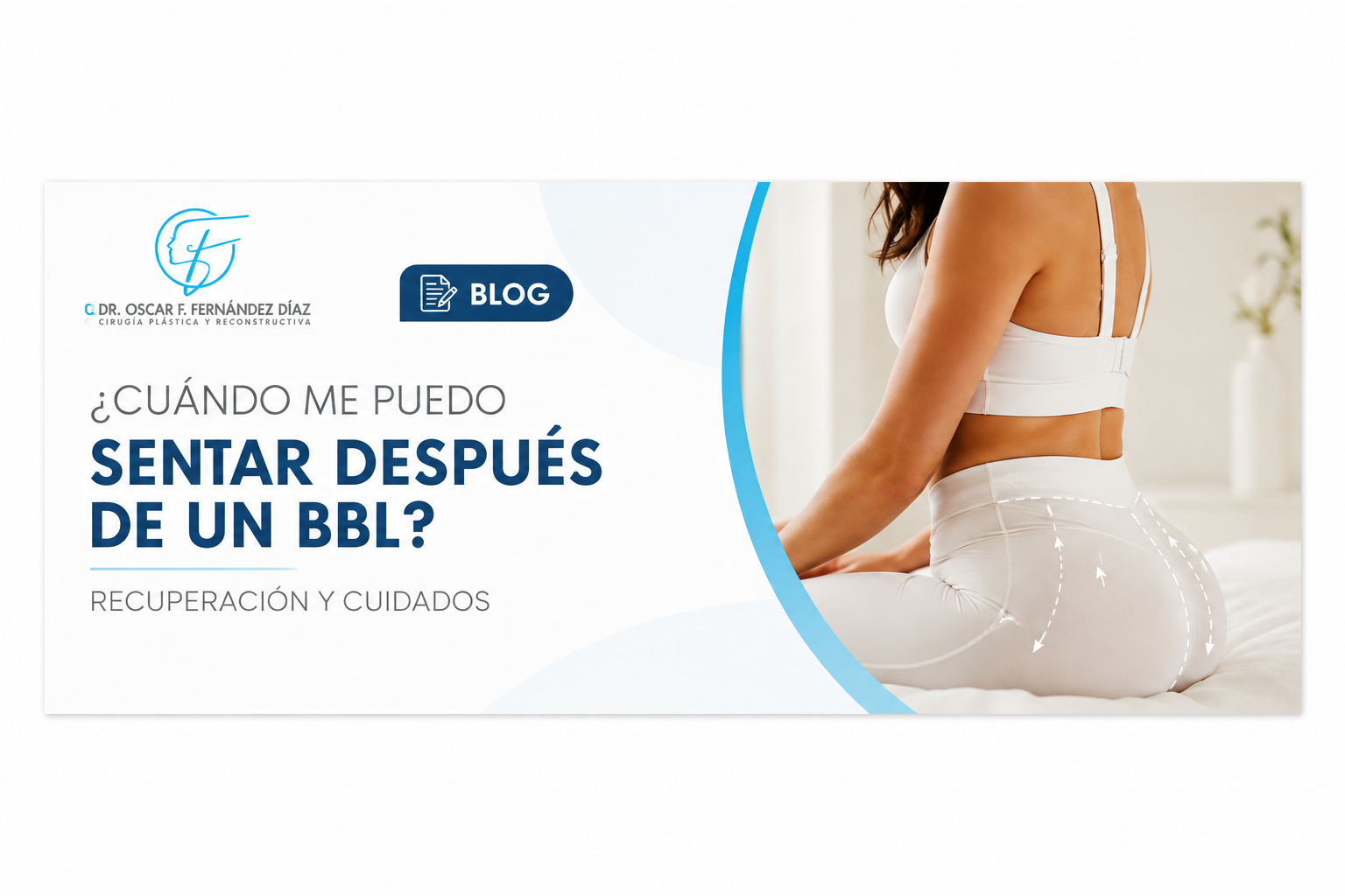 ¿Cuándo me puedo sentar después de un BBL? Recuperación y cuidados