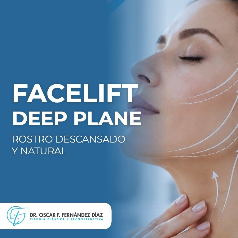 Dr. Oscar Fernández, facelift deep plane en Guadalajara