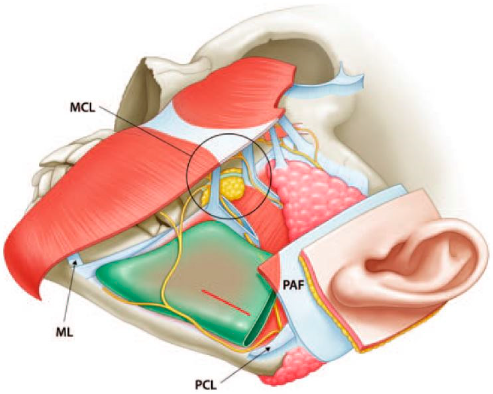 Espacio premasetérico, ligamentos de retención y ramas del nervio facial (Lee et al., J Clin Med 2023, CC BY 4.0)